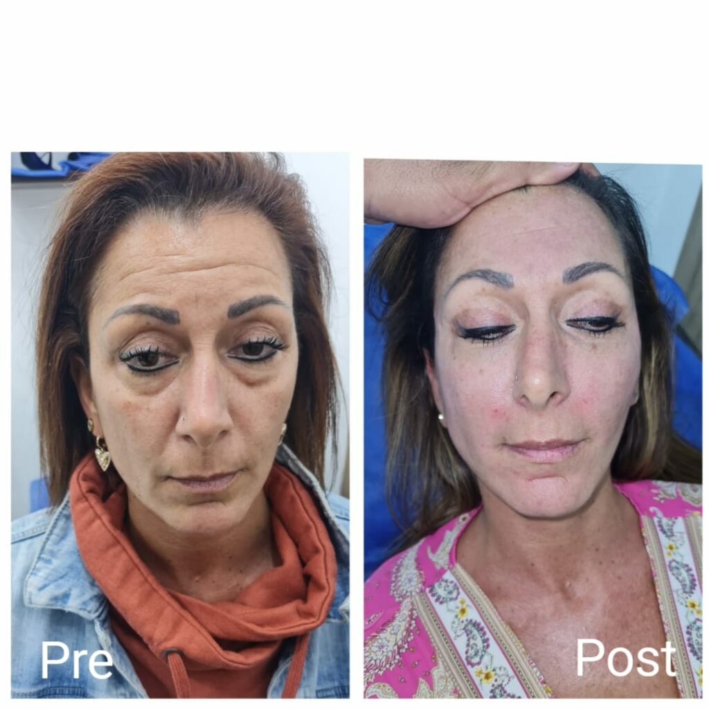 خيوط ذهبية للوجه